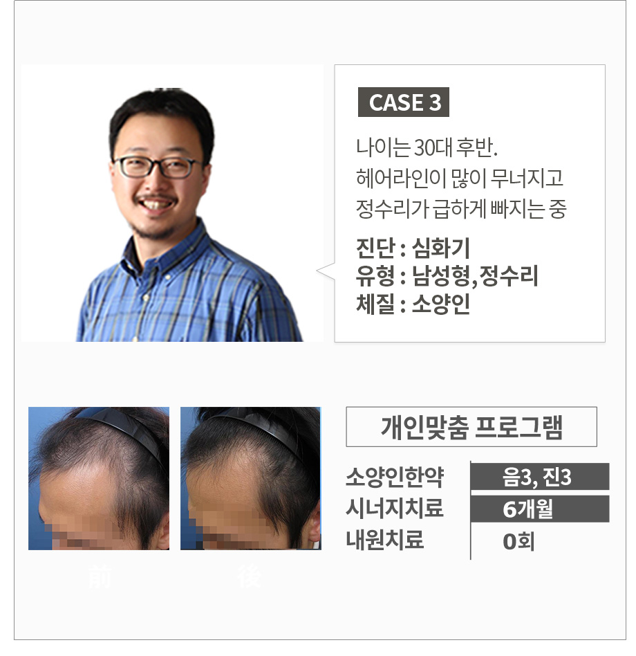 나이는 30대 후반. 헤어라인이 많이 무너지고 정수리가 급하게 빠지는 중