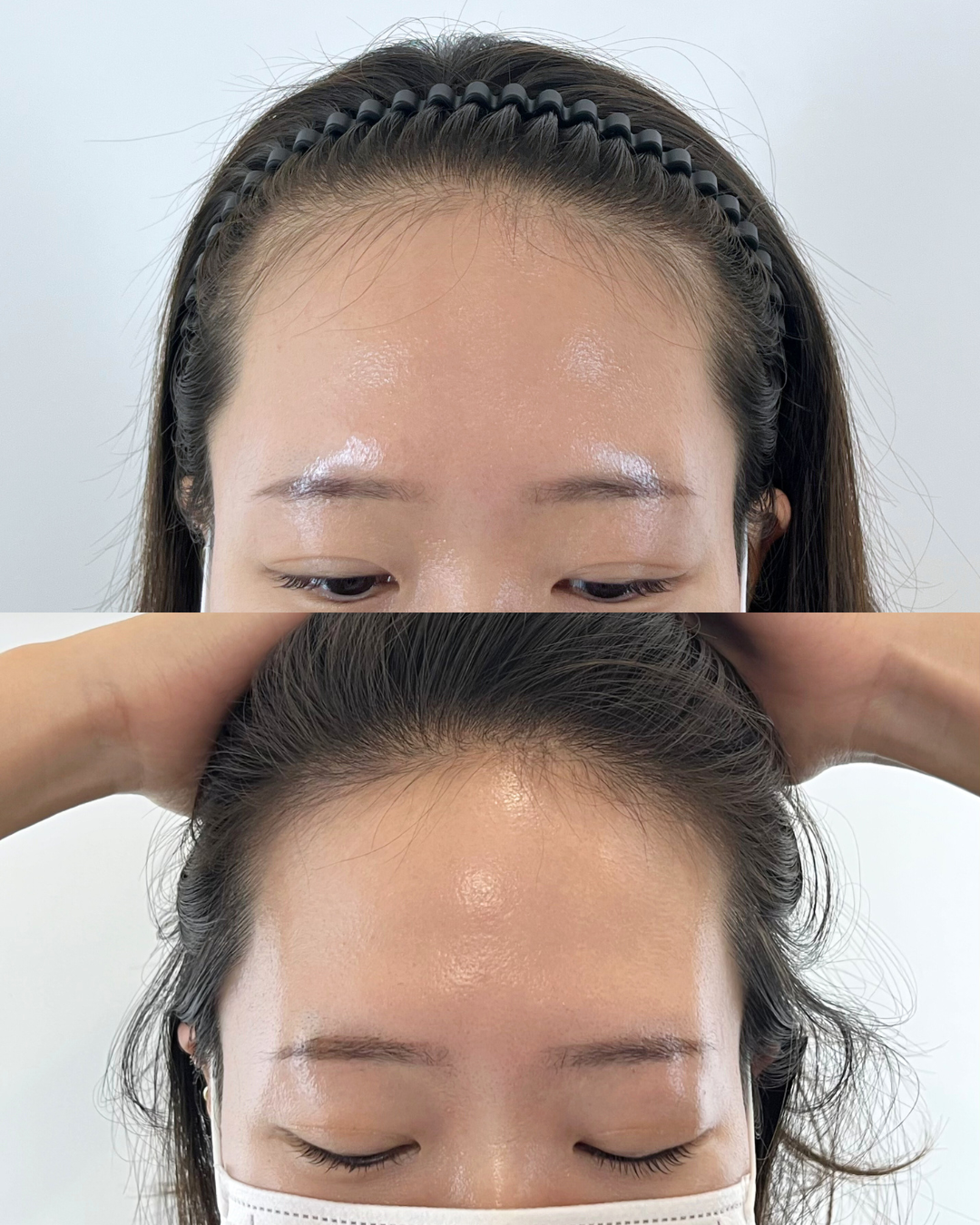 9호선 마곡나루역 인근 스튜디오에서 반영구 헤어라인 모델을 모집합니다

수강 모델 구인이 아닌, 추가 포트폴리오를 위해 업력 7년차 원장이 직접 작업해요

고가의 프리미엄 시술 무료로 체험하시고 탈모 스트레스로부터 벗어나세요 :)