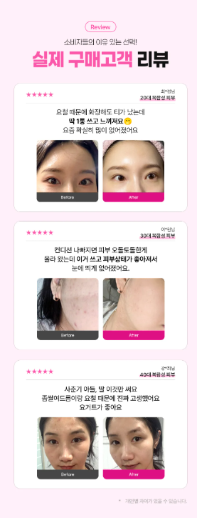 공구/공동구매 캠페인 | 수수료 최대 50%!!
다년간의 노하우로 운영부터 성과관리까지 지원합니다. 수익화를 원하시는 분들을 환영합니다.

발효 유산균과 7가지 특허 성분으로 무너진 장벽은 살리고 노폐물은 말끔하게 비워내는 저자극 클렌징 밀크

*원고료/일정 협의가능