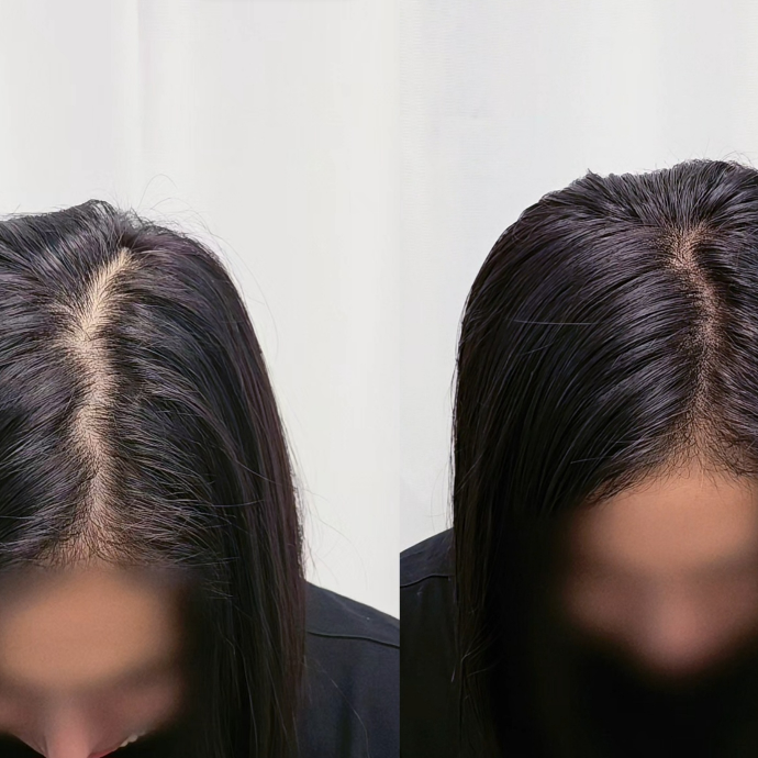 두피 커버 체험단 모집