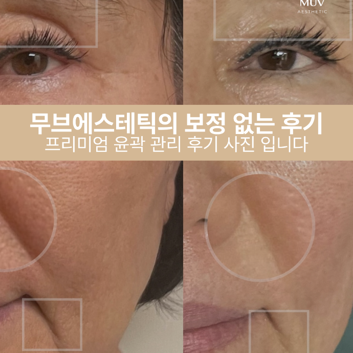 문제성 피부관리·윤곽리프팅·프리미엄수분관리