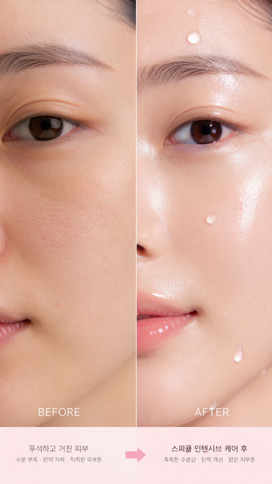 히알루론산 동결건조 멜팅볼 × 스피큘
72시간 수분 밀도의 차이, 릴스로 증명하세요