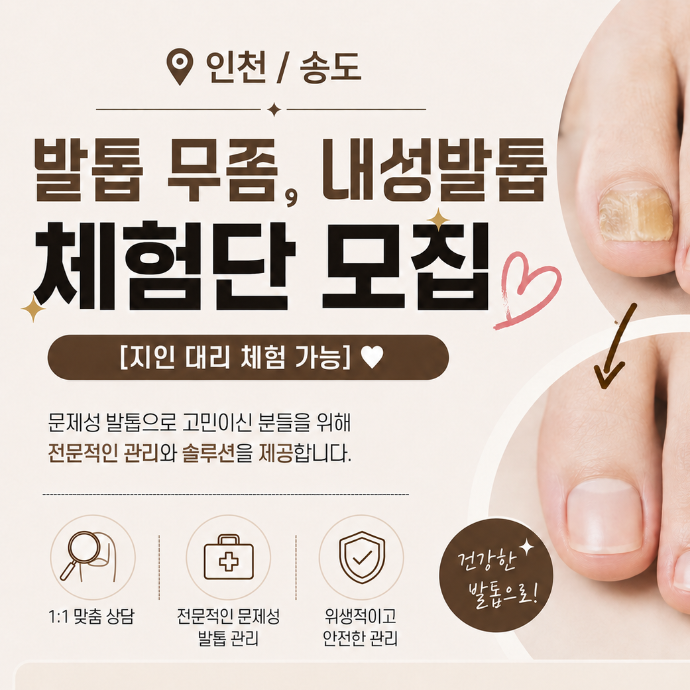 인천/송도 발톱 무좀, 문제성발톱 체험단 모집 [지인 대리 체험 가능]❤️